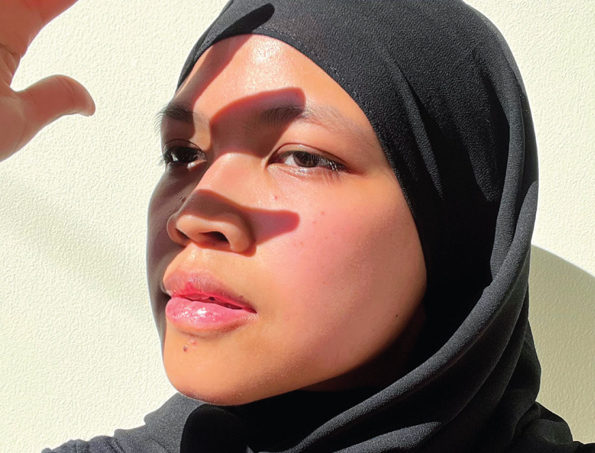 #BLPFAM | SKIN JOURNEY OF A LUPUS FIGHTER, EIDI PUTRI