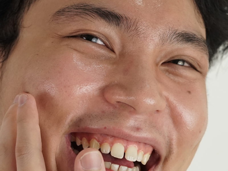 #NOWTALKING | HYDRATING VS MOISTURIZING – PILIH YANG MANA YA?
