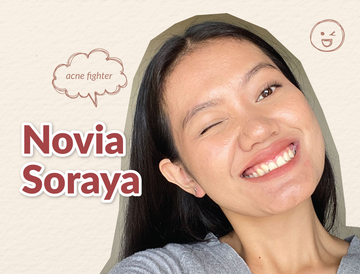 #BLPFAM | THE ACNE JOURNEY OF NOVIA SORAYA