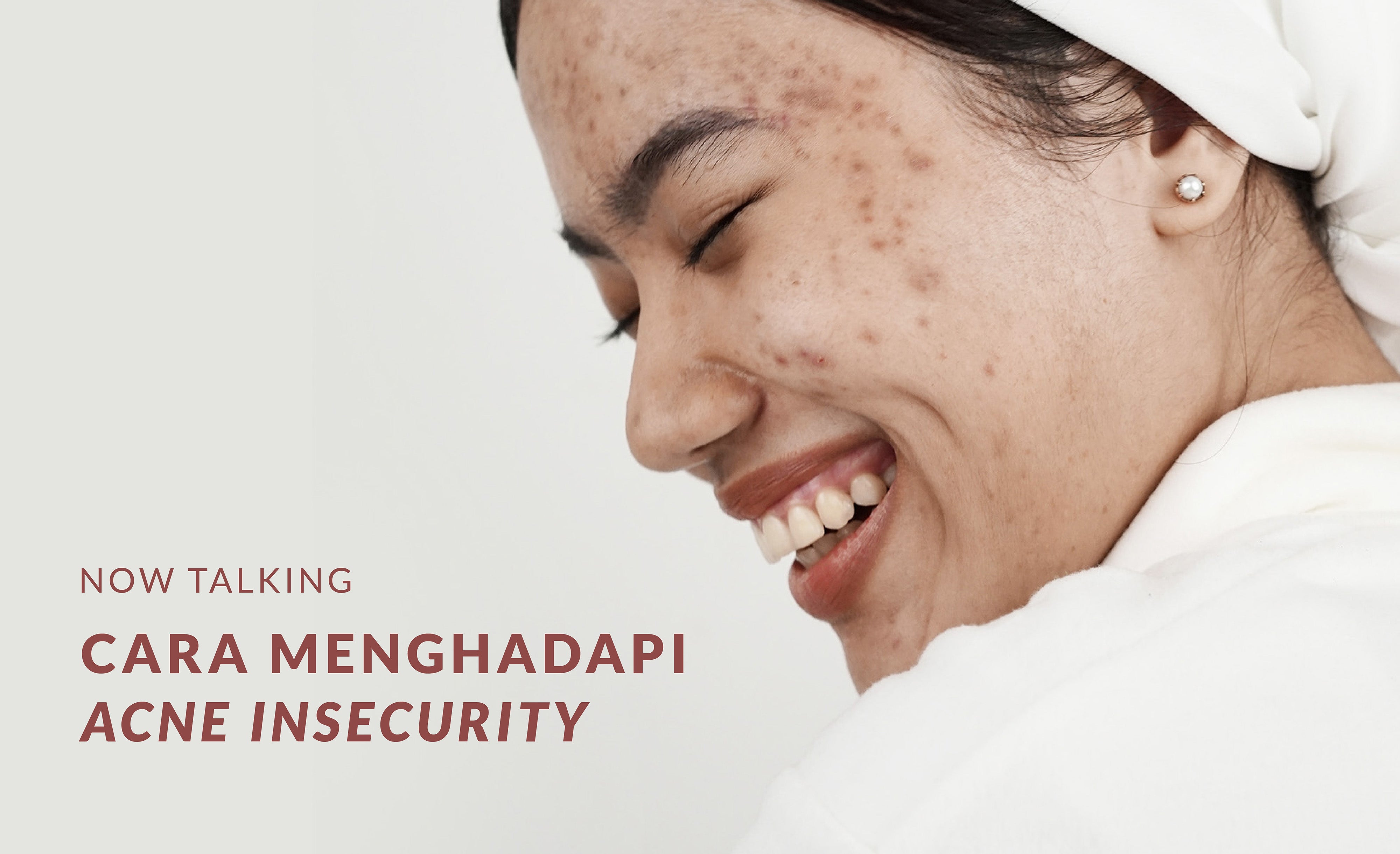 NOW TALKING | CARA MENGHADAPI ACNE INSECURITY